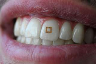Dent intelligente : un capteur pour analyser vos repas