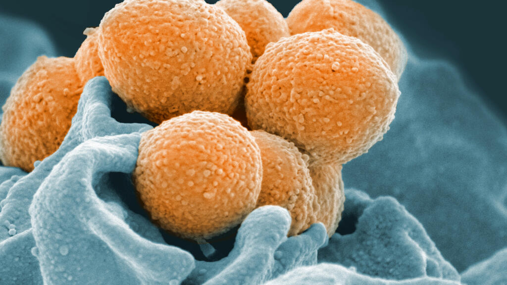 France: une recrudescence d’infections graves à streptocoque A qui pose question