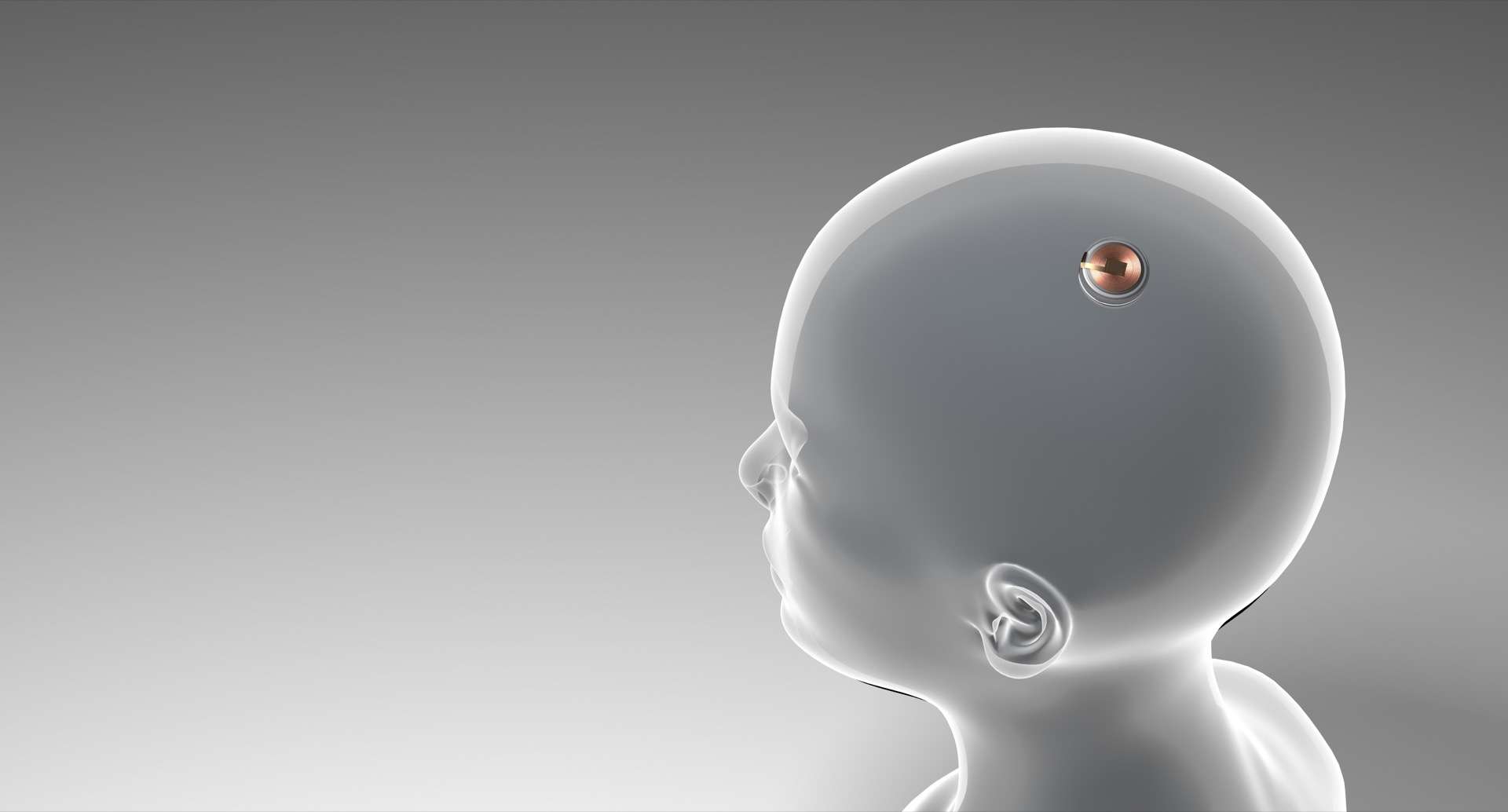 Neuralink : Elon Musk veut donner la vue aux aveugles et faire marcher les paralysés
